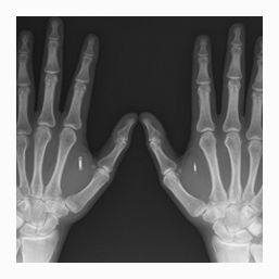 X-Ray Negative Services in Oxfordshire UK